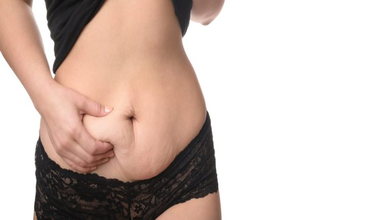 تورم بعد از لیپوماتیک شکم