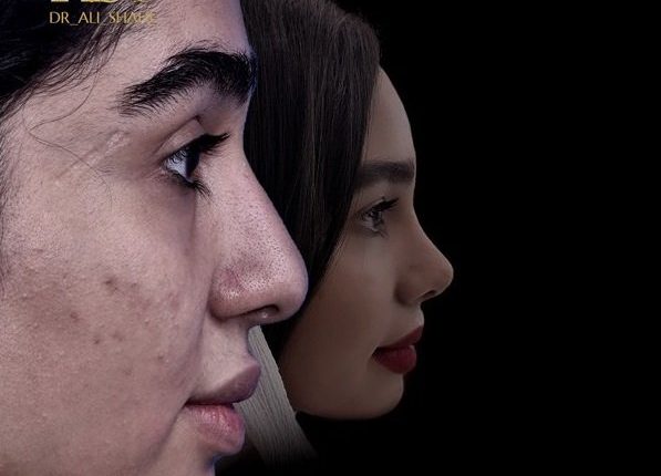 بهترین جراح بینی کرج