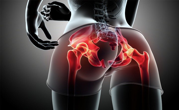 عمل جراحی تعویض مفصل لگن