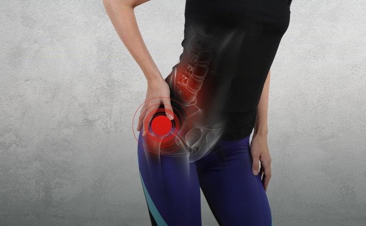 ارتباط آرتروز لگن و جراحی تعویض مفصل لگن