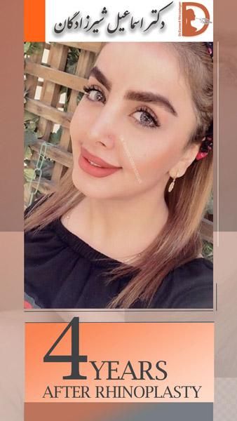 تجربه و تخصص جراح زیبایی بینی