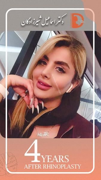 عوامل موثر در هزینه جراحی بینی