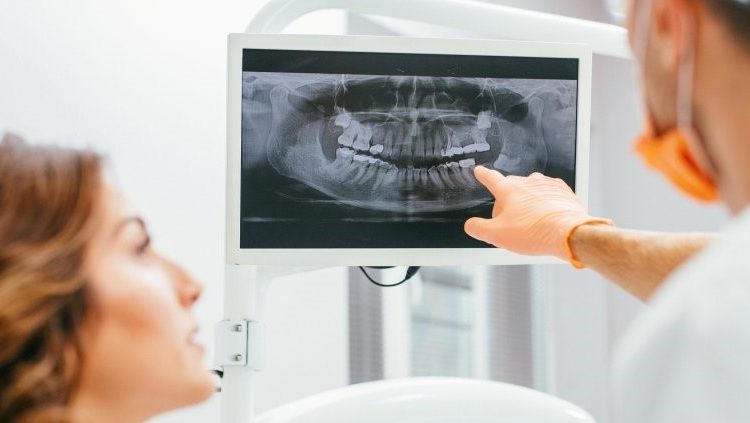 رادیوگرافی چیست و نکات مهم خرید یونیت