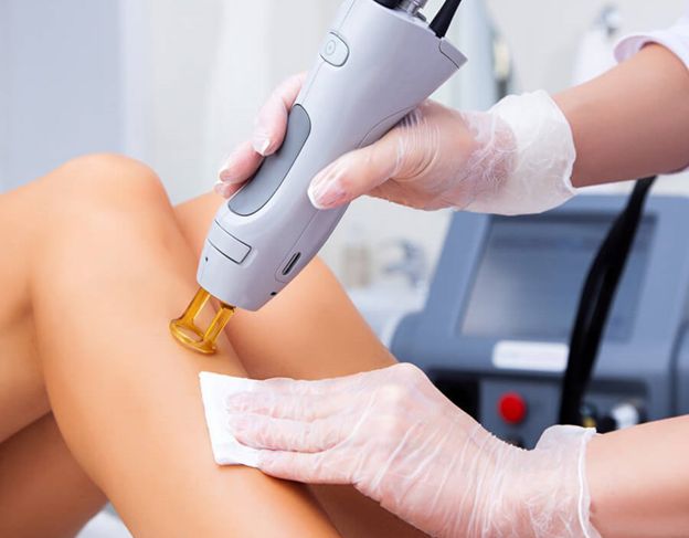 همه چیز در باره لیزر موهای زائد